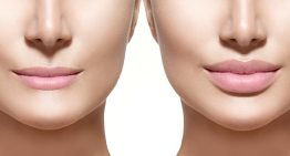 Get the Look You Long for With the Help of Plastic and Cosmetic Surgeries in Houston