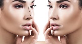 Improve your Physical Appearance with Rhinoplasty
