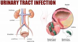10 Tips to Avoid Urinary Tract Infections